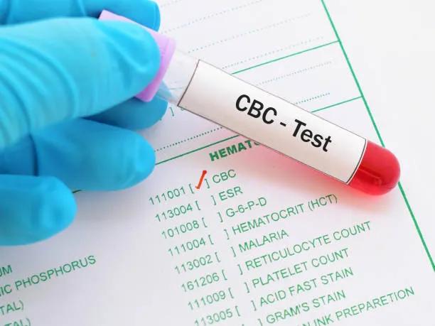 Cbc Key Complete Blood Count Test | IQ Labs Diagnostics Speciality